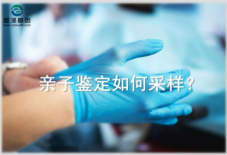 偷偷撿了一把頭發(fā)可以送去做親子鑒定嗎？