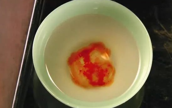 親子鑒定檢驗(yàn)血型血痕，被鑒定人應(yīng)了解自己或近親屬有無(wú)遺傳病史