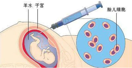 孕期做胎兒親子鑒定合適嗎？孕期有哪些胎兒親子鑒定方法？