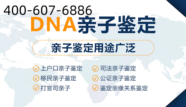 中山上戶口親子鑒定辦理有什么注意事項嗎？