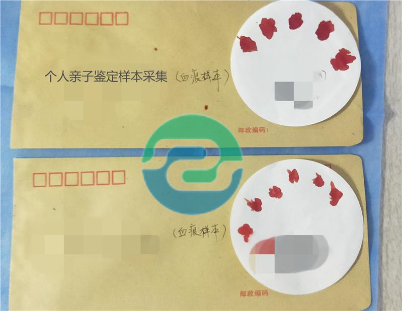 辦理中山親子鑒定需要預約嗎？